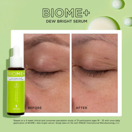 BIOME_-DEW-BRIGHT-SERUM-PDP-R08_a6b1915c-a6bc-4b2e-94ff-ed6ad8e32b2b