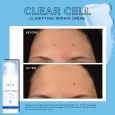 CLEAR-CELL-CLARIFYING-REPAIR-CREME-BEFORE-AFTER