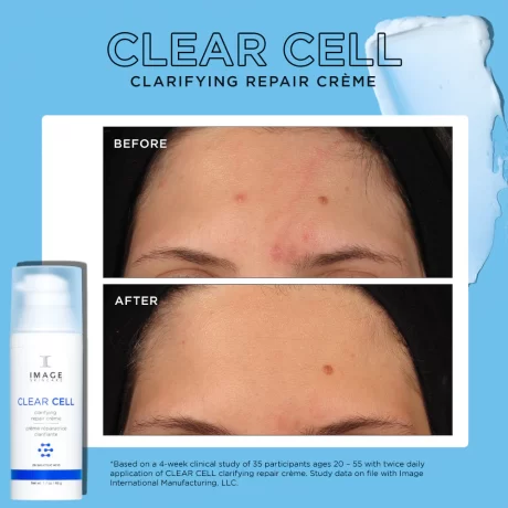 CLEAR-CELL-CLARIFYING-REPAIR-CREME-BEFORE-AFTER