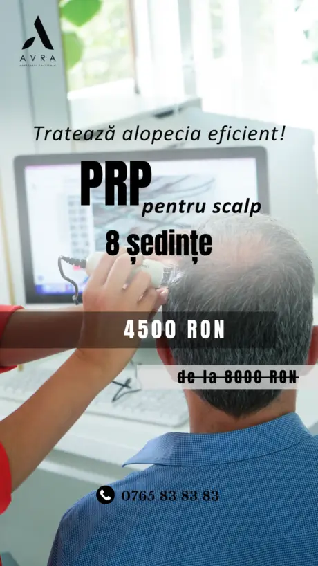 PRP pentru scalp 